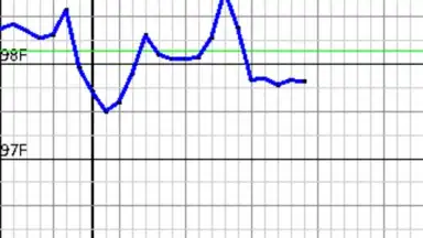 Capture d'écran de My Days - Period & Ovulation 4