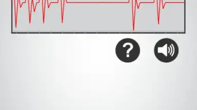 Capture d'écran de Monitor Heart Rate 5