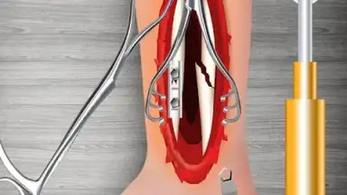 Capture d'écran de WristSurgeryDoctor 15