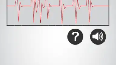 Capture d'écran de Heart Rate Monitor 4