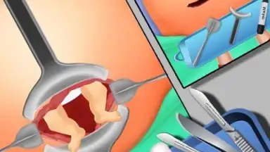 Capture d'écran de EmergencySurgery 2