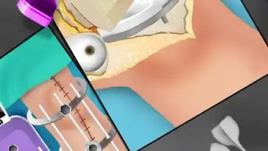 Capture d'écran de KneeSurgery 1