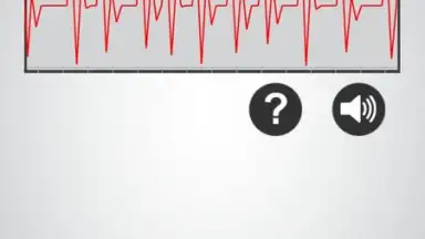 Capture d'écran de Monitor Heart Rate 4