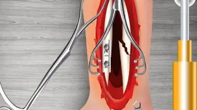 Capture d'écran de WristSurgeryDoctor 9