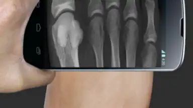 Capture d'écran de X Ray Scanner Pro 1