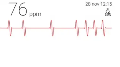 Capture d'écran de Cardiograph 2