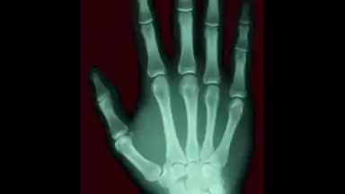 Capture d'écran de Scanner X-ray 5