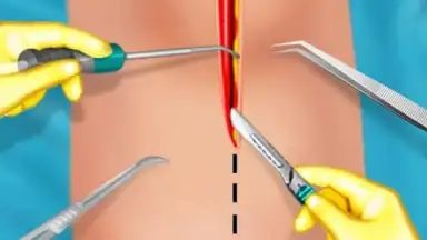 Capture d'écran de KneeSurgery 2