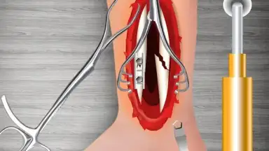 Capture d'écran de WristSurgeryDoctor 2