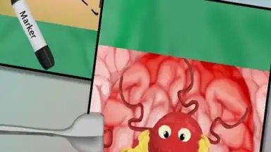 Capture d'écran de BrainSurgery 2