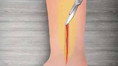 Capture d'écran de WristSurgeryDoctor 16