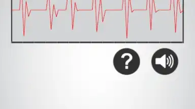 Capture d'écran de Heart Rate Monitor 2