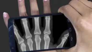 Capture d'écran de X Ray Scanner Pro 2
