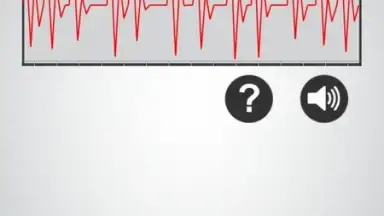 Capture d'écran de Monitor Heart Rate 1